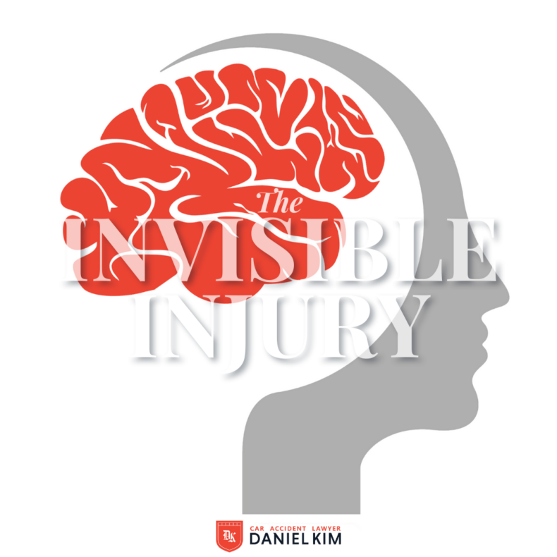The Invisible Injury: Shedding Light on Traumatic Brain Injuries - DK Law