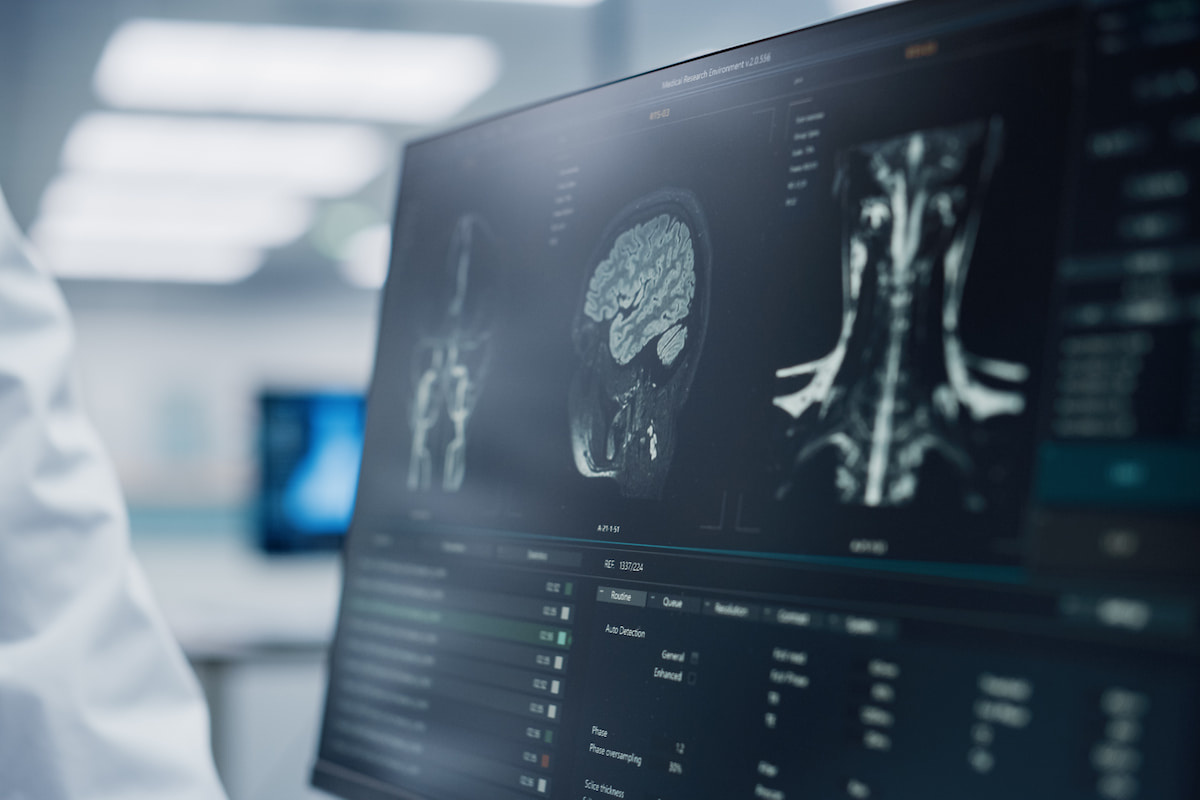 Un neurólogo y un neurocirujano analizan la resonancia magnética de una lesión cerebral