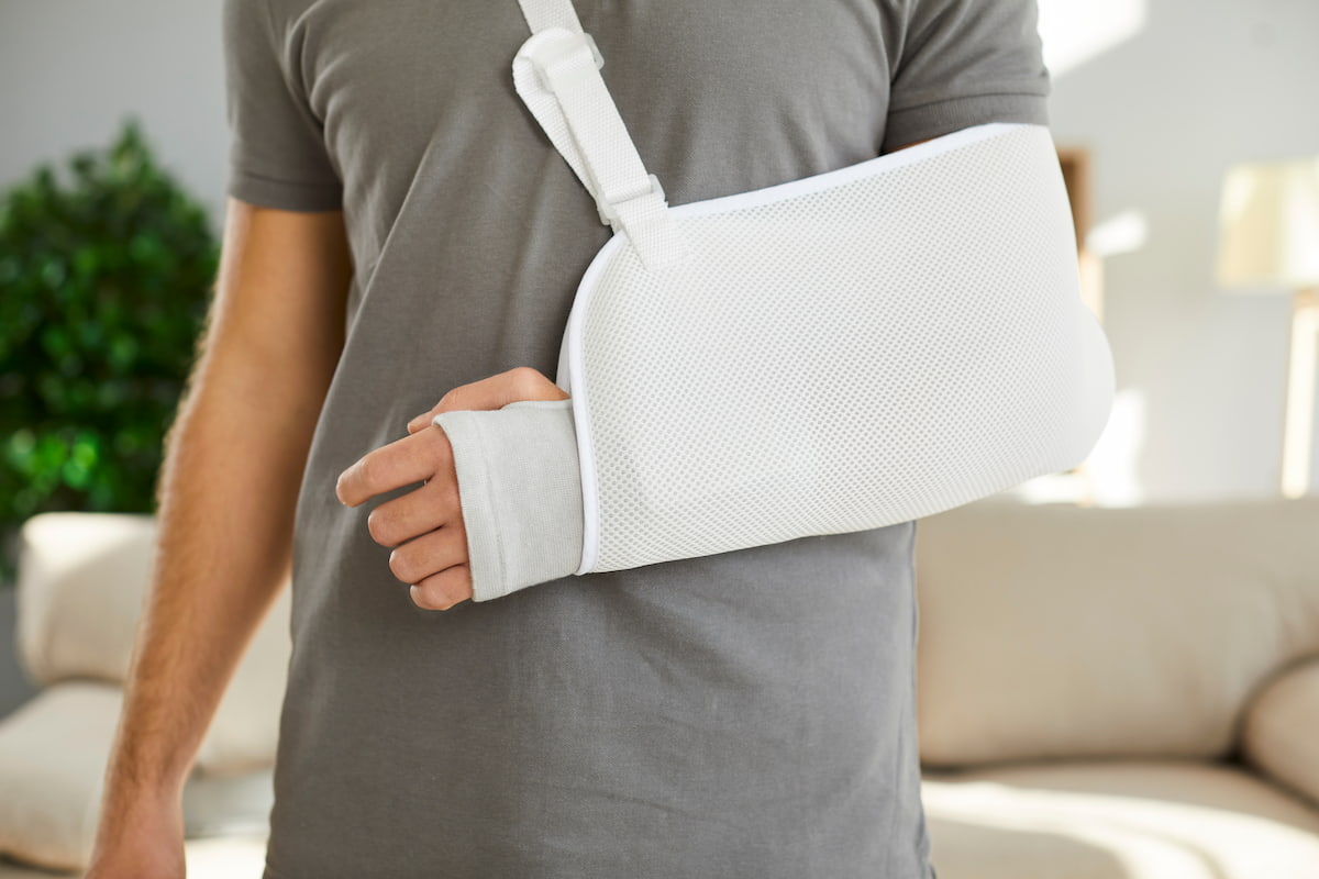 Close up of a man wearing an arm cast inside of a sling