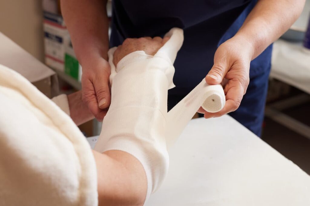 Doctor puts a plaster on the arm of a patient in the hospital with a broken arm