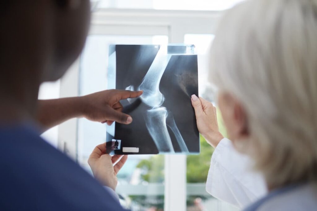 Team, doctor and hands of nurse with x ray for bone surgery, discussion or treatment plan.