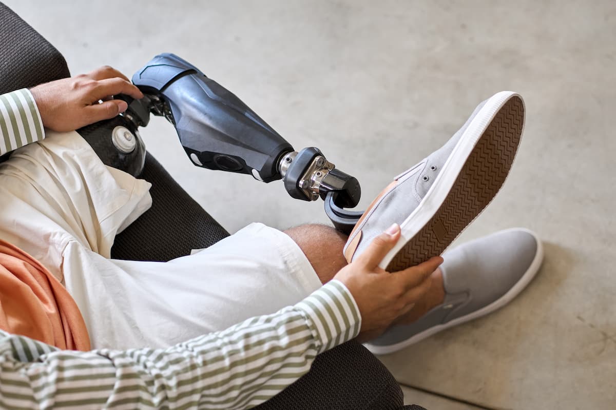 Man amputee with prosthetic leg disability on above knee