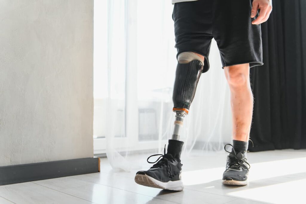 Man with bionic prosthetic leg at home