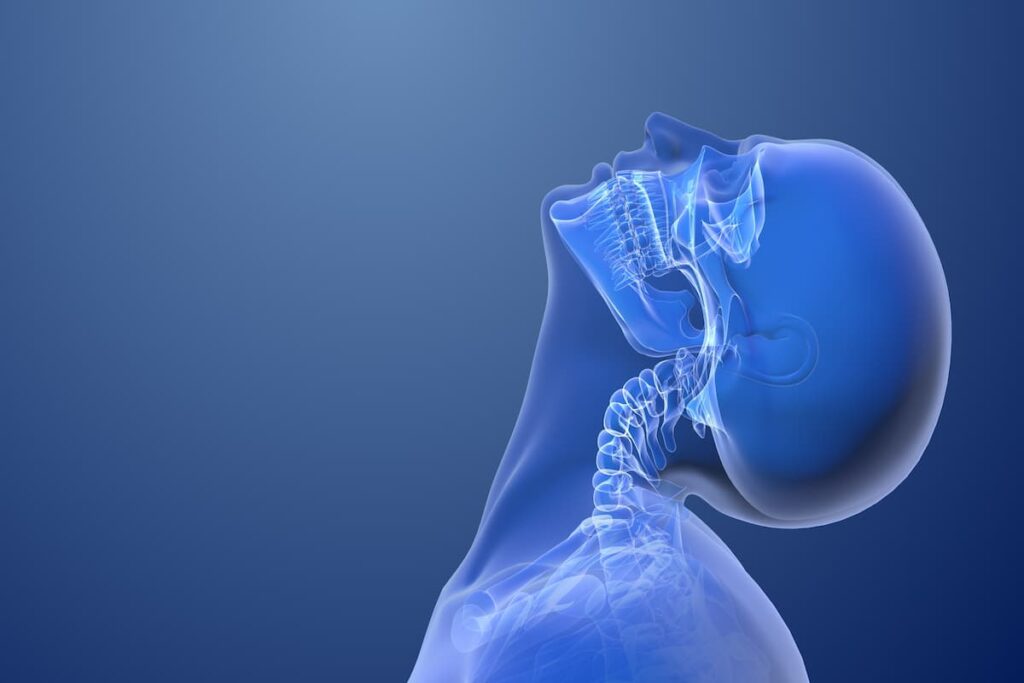 Cervical Spine Whiplash Injury from Impact 3d illustration