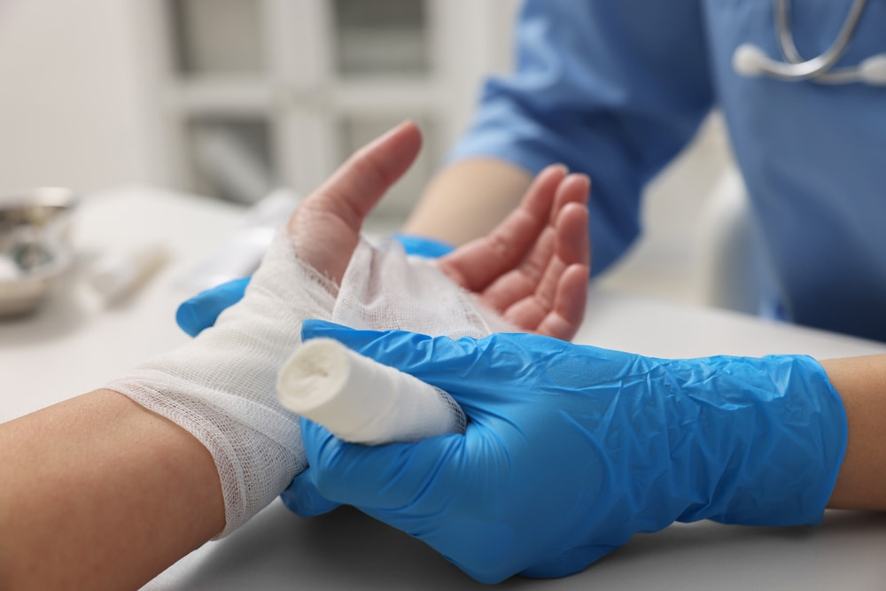 Medical professional wrapping a bandage around a patient's burned hand.