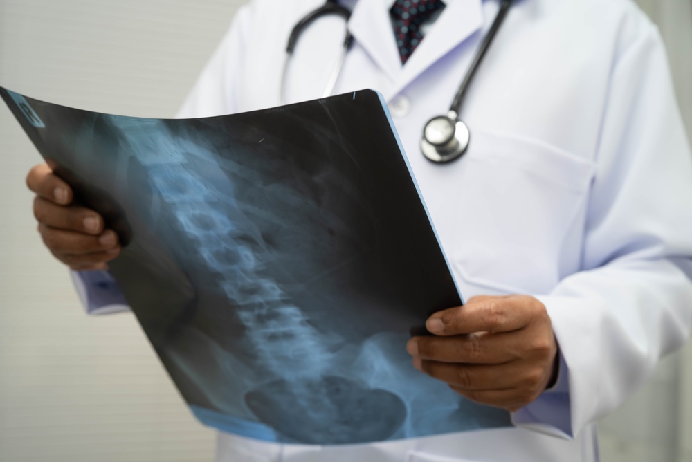 Doctor examining a spinal X-ray while wearing a white coat and stethoscope