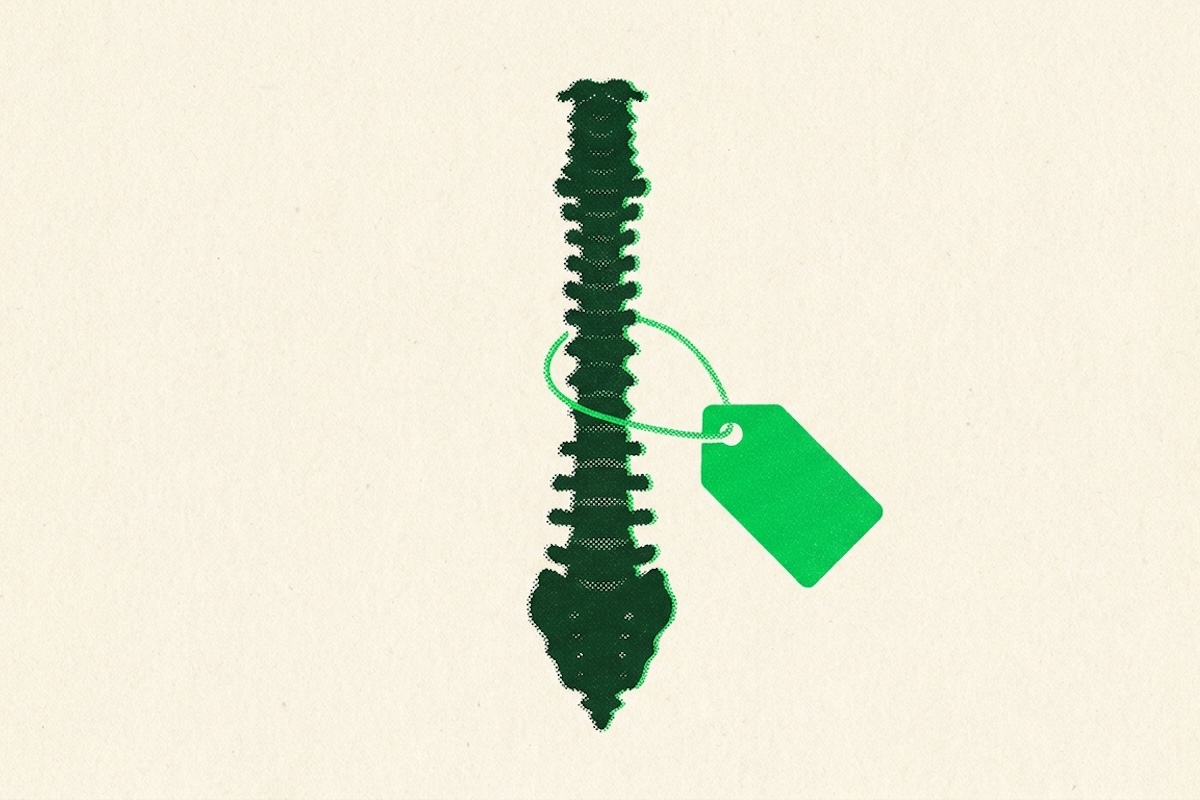 Illustration of a spine with a price tag attached, representing medical billing.